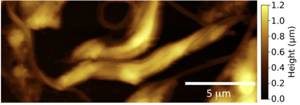 SFM image of Leishmania